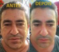 /album/algunos-resultados-reales/a10407891-482301978584047-6617430958611788376-n-copia-copia-jpg/